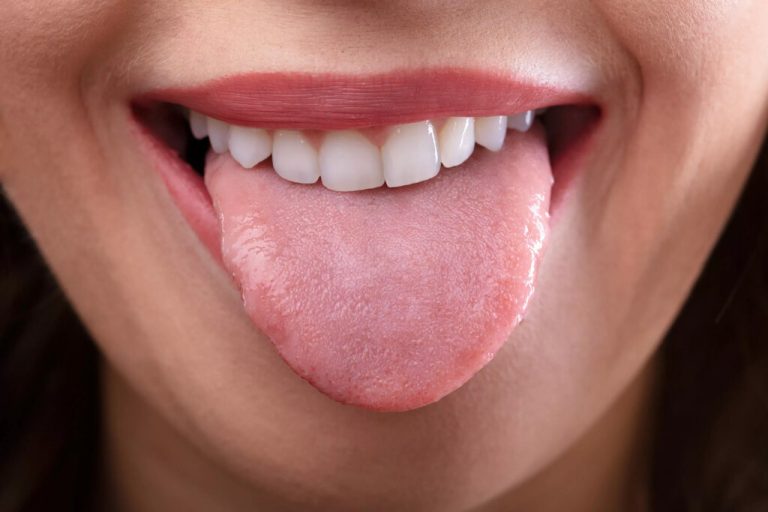 The Tongue Dental